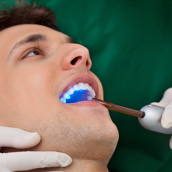 Dentist in Fort Worth applying a white filling to a patient's tooth